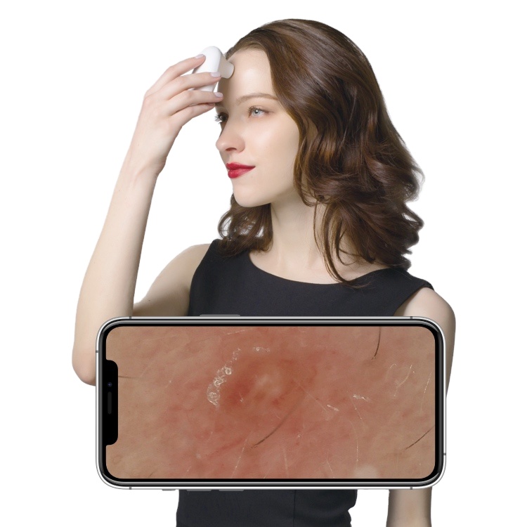 Portable Dermatoscope Skin Detector Skin Hair Analyzer For Home And Commercial Use 