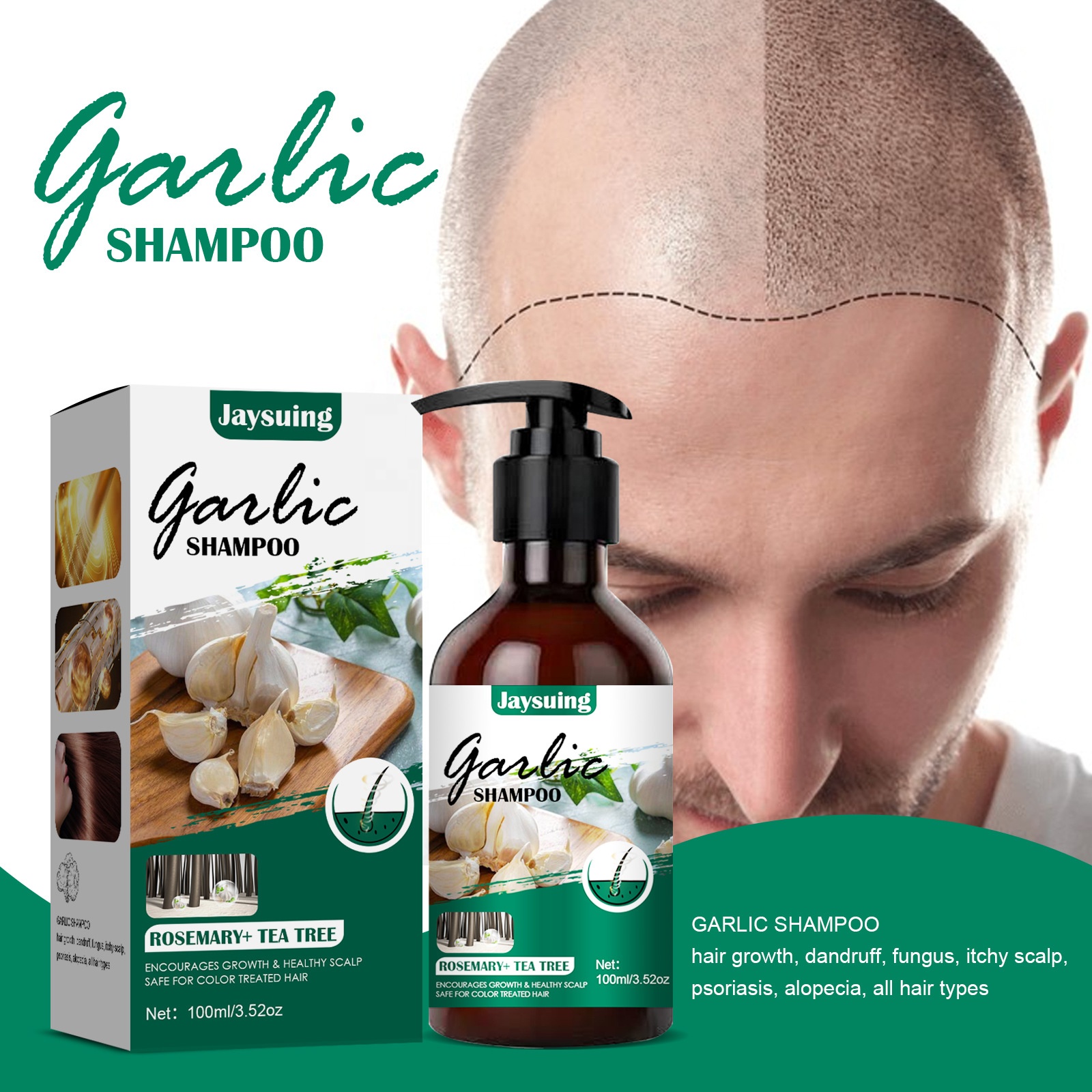 Private Label Organic Clean Itching Anti-dandruff Nourishing Anti Hair Loss Hair Growth Garlic Shampoo And Conditioner 